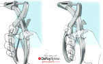 Surgical Spine Instrument - photo №3 | Baren-Boym.com