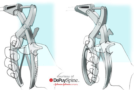Surgical Spine Instrument - photo №4 | Baren-Boym.com