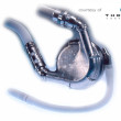 HeartMate LVAD | Baren-Boym.com